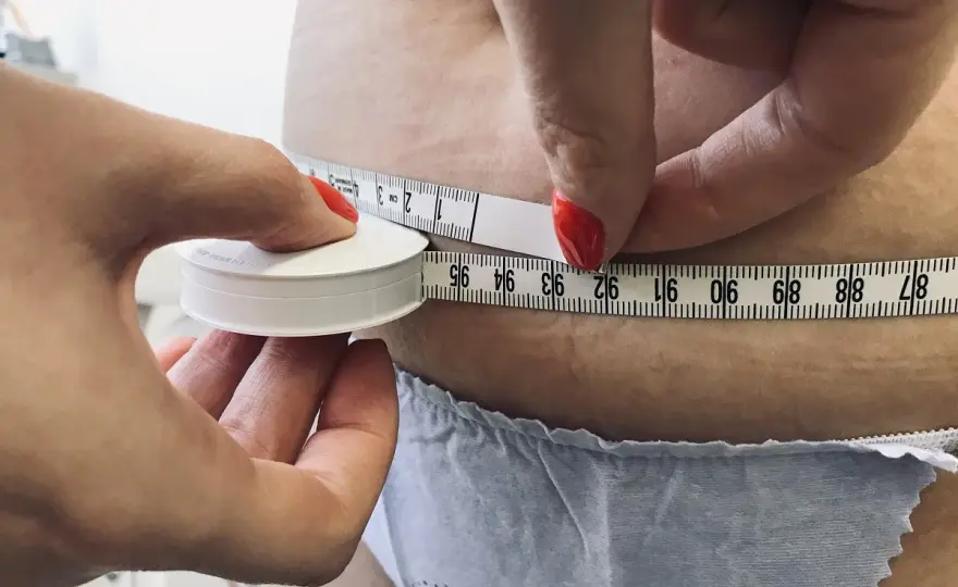 Liposukcja ultradźwiękowa: jak wygląda zabieg i czego się spodziewać